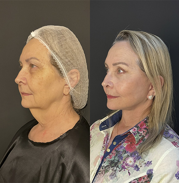 Sem Título-2_0008_5