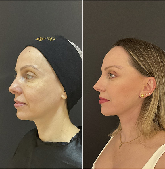 Sem Título-2_0009_4