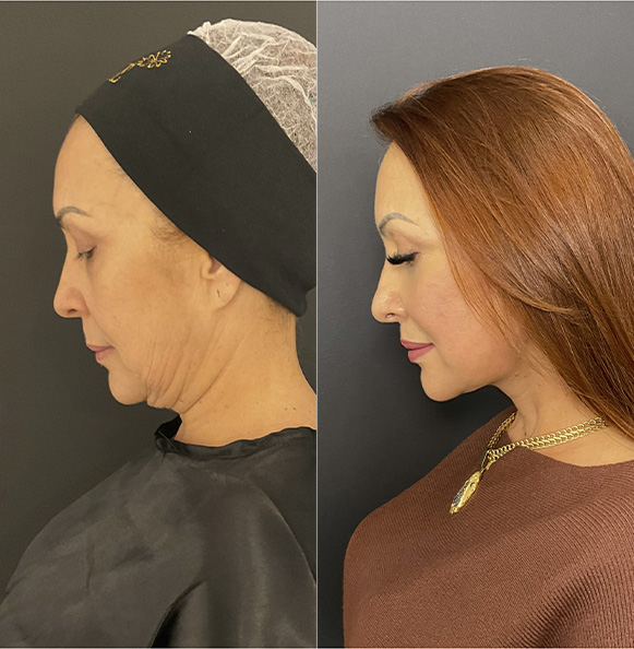 Sem Título-2_0012_Camada 1